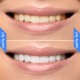 Teeth Whitening Paste